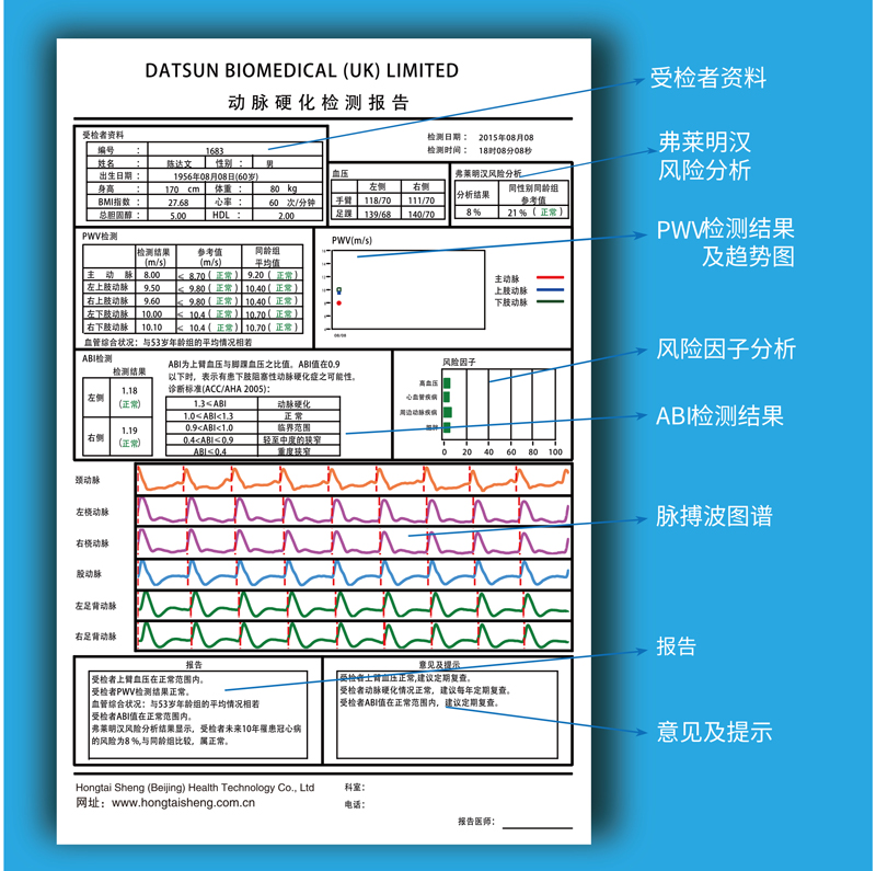 動脈硬化檢測儀