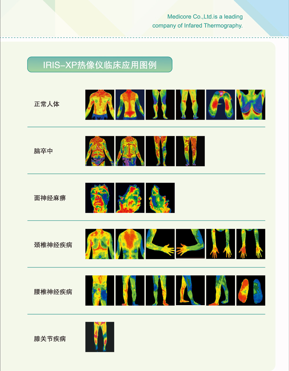 紅外熱像儀