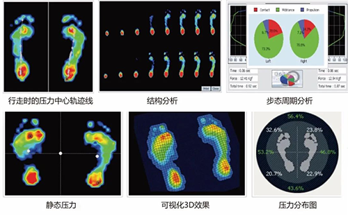 足底壓力分析儀