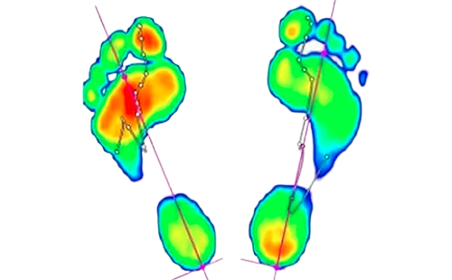 足底壓力檢測儀