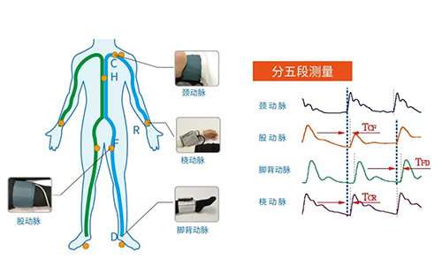 脈搏波速測(cè)定儀