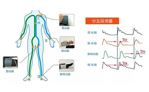 脈搏波速測定儀