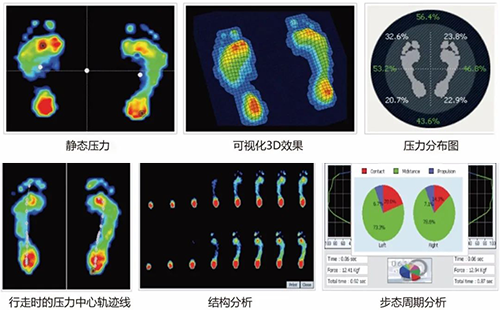 足底壓力分析儀