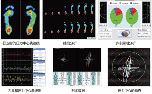 足底壓力測試儀